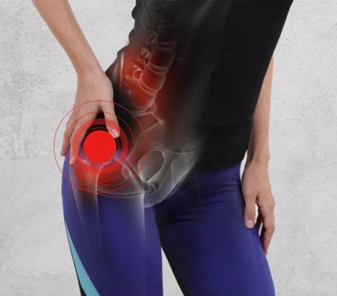 dolor de cadera